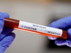 ارتفاع عدد حالات الإصابة بفيروس كورونا في إسرائيل إلى 75