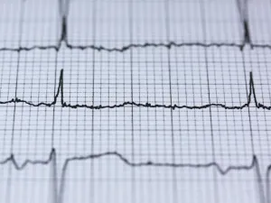 من أعراض النوبة القلبية الشعور بالضغط والضيق والألم في الصدر والذراعين 