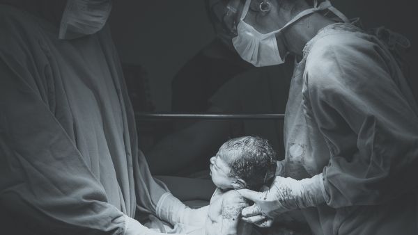حقائق لا تعرفينها عن الولادة القيصرية