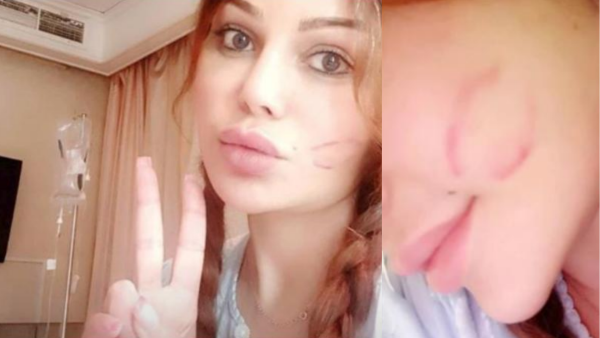 Haifa Wehbe stopped all her art activities and devoted herself to treatment for nearly a month Source haifawehbe Instagram