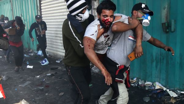 In this file photo taken on November 15, 2019, Iraqis carry a protester wounded after being struck by a tear gas canister amidst clashes with security forces at the capital Baghdad's Khallani square during ongoing anti-government demonstrations. At least 3,000 people who have been maimed in Baghdad and southern Iraq since anti-government protests erupted on October 1, according to the NGO Iraqi Alliance for Disabilities Organisation (IADO). After decades of back-to-back conflicts, Iraq is in the thick of it