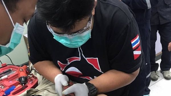 A 21-year-old Thai man was hospitalised on Sunday after getting his penis stuck inside a metal cylinder (dailymail)