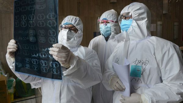 This photo taken on February 20, 2020 shows doctors looking at a lung CT image at a hospital in Yunmeng county, Xiaogan city, in China's central Hubei province. AFP/File