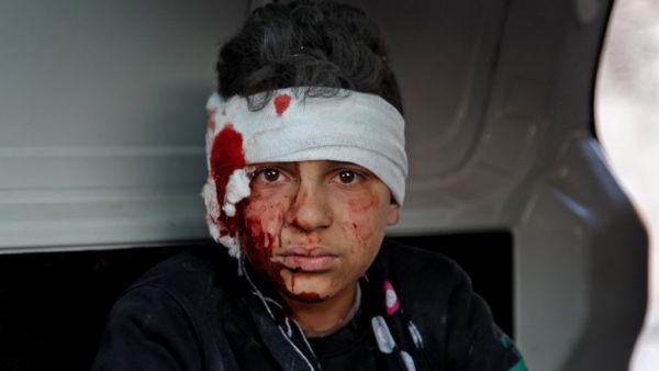 A wonded Syrian child sits inside a vehicle as he is evacuated from the scene of a pro-regime forces air strike in the town Maarrat Misrin in Syria’s northwestern Idlib province, on February 25, 2020. Abdulaziz KETAZ / AFP