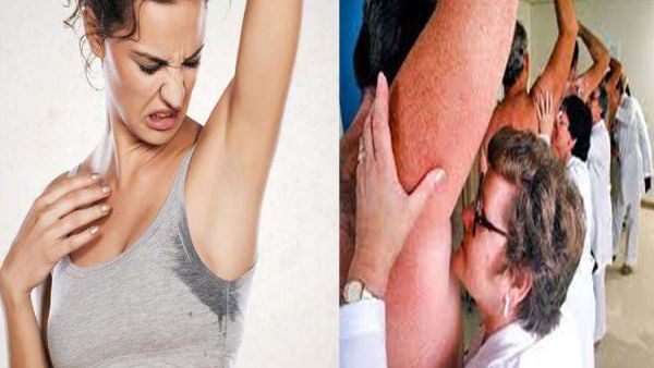 إبط