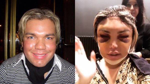 Roddy - who came out as transgender recently - is in Belgium