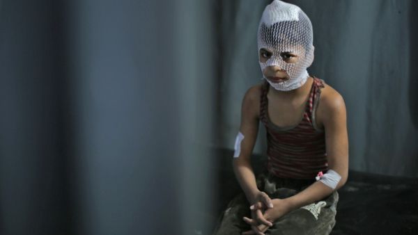 A wounded Syrian child sits at a makeshift clinic in the town of Maaret Misrin following Syrian government forces airstrikes on March 5, 2020 in the country's northwestern Idlib province. Russian air strikes killed at least 15 civilians including a child in the last major opposition bastion of Idlib in northwestern Syria, a Britain-based war monitor said.  Aref TAMMAWI / AFP