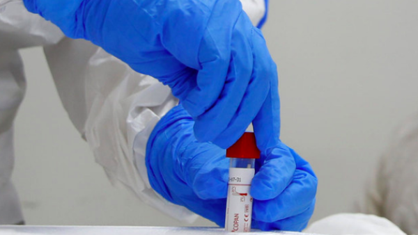 sreal will use security measures in its fight against the virus. (File/AFP)