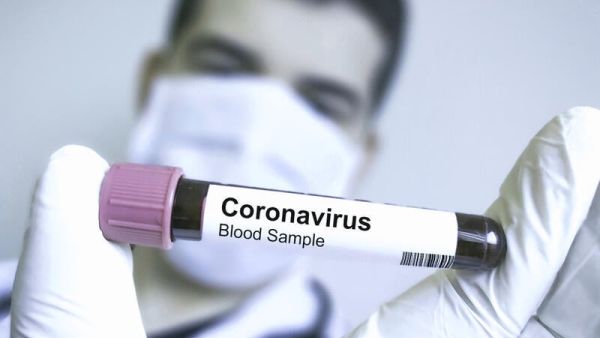 (Shutterstock/ File Photo)