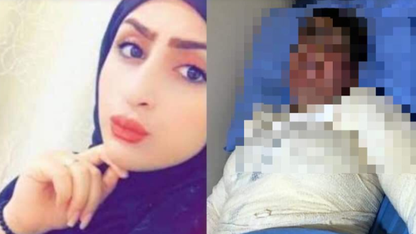 Set on Fire by Husband: Iraqi Victim Sparks Social Media Calls for Women's Protection