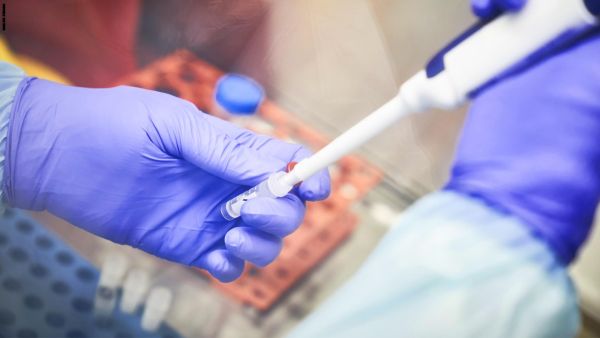  الأطباء يجرون حاليا تجارب سريرية على 86 مريضا مصابين بفيروس كورونا