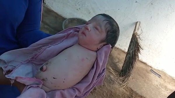 A baby girl has left doctors and family members baffled in India after she was born without arms or legs (SWNS/Dailymail)