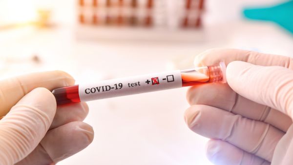 Coronavirus Test. (Shutterstock/ File Photo)