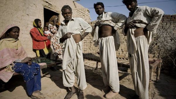 Pakistan Mohamed Ijaz, 25, (2R), displays his scar along with brother Mohamed Riiz, 22, (R), and father Karm Ali, 65, (2L), as his wife Farzana Ijaz, 20, (L), looks on outside his house at a brick factory in Rawalpindi on the outskirts of capital Islamabad on November 18, 2009. (AFP/File Photo)