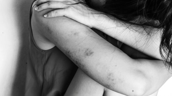 (Shutterstock/ File Photo)