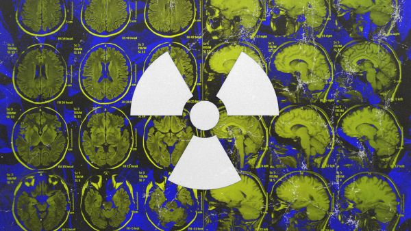 Radiation exposure (Design by Rami Khouri) 
