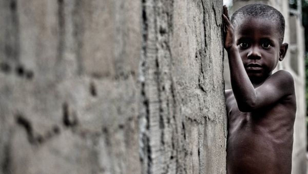 Nigerian boy suffering from malnutrition. (Shutterstock/ File Photo)