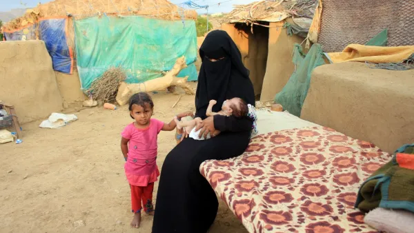 A woman carries a young infant suffering from severe malnutrition since birth in Yemen's northern Hajjah province on December 6, 2020. ESSA AHMED / AFP