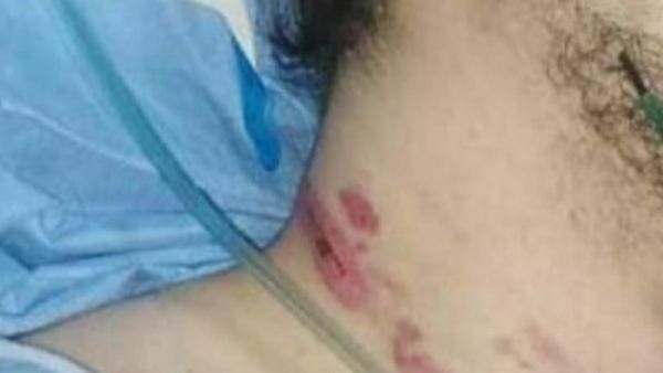 الفتى المعتدى عليه