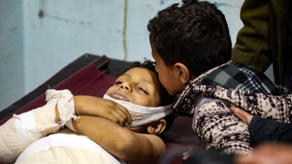 A Yemeni boy kisses the forehead of a killed youngster, following a reported mortar shell attack on the country's third city of Taez, on February 20, 2021. Yemen is engulfed in a bloody power struggle that erupted in 2014 between its government, supported by Saudi Arabia, and Iran-backed Huthi rebels, who control the capital Sanaa and most of the north. AHMAD AL-BASHA / AFP