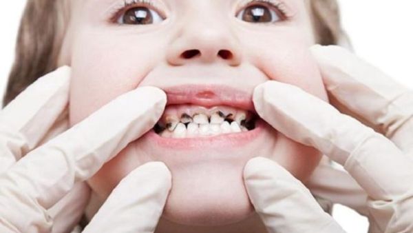 يجب تقديم العصائر فقط أثناء الوجبات أو عدم تقديمها على الإطلاق.