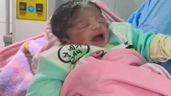 طفلة بشعر أبيض