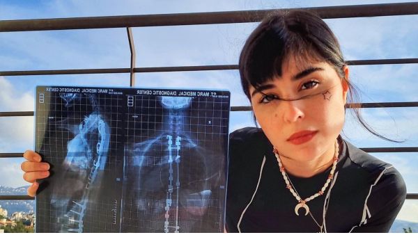 Zeina Makki Nabil Khoury religion difference marriage muslim christian Scoliosis 