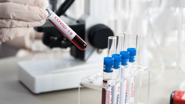 WHO said it was "extremely unlikely" that the virus spread from a Wuhan lab