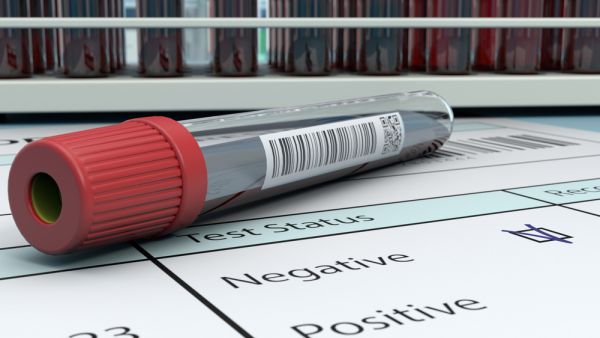 Watch out! Fake Covid tests on the Increase!