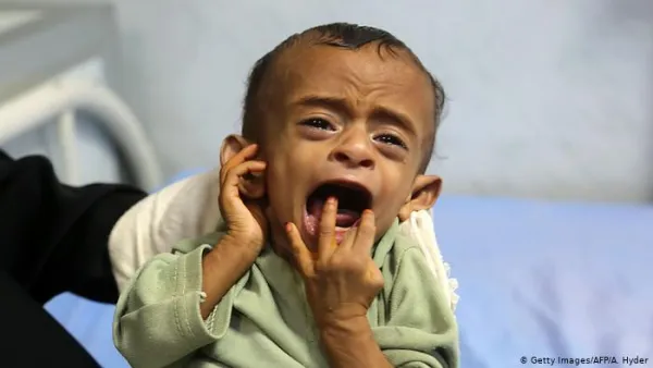 Spare a thought for the Yemeni kids 