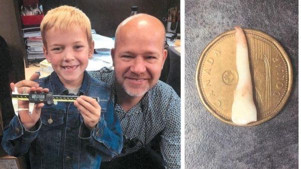 Luke Boulton won world record for longest tooth