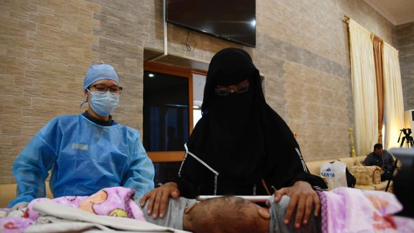 Yemeni conjoined twins Yousef and Yassin arrived to Riyadh 