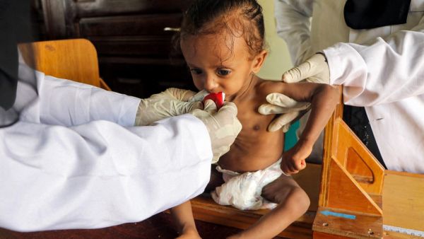 Yemen is accused of violating children's rights.