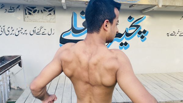 Furqan bin Imran suffers from a very rare type of skeletal abnormality called pycnodysostosis. 