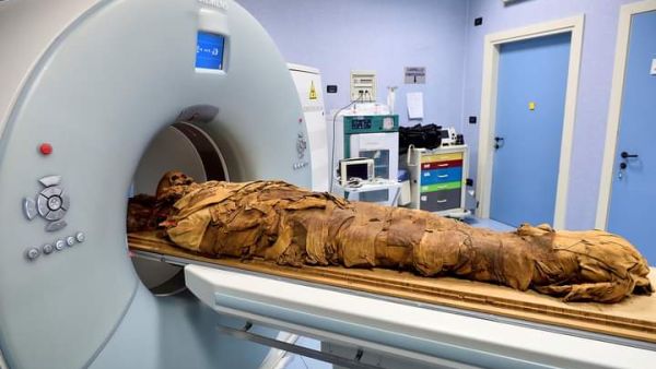 An Egyptian mummy undergoes a CT scan at the Policlinico hospital, Milan so that researchers to investigate its history