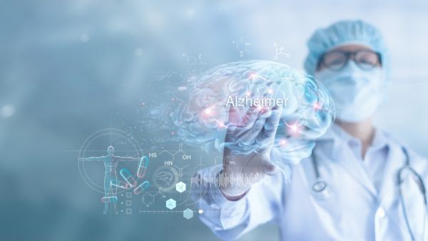 Doctor checking and analysis alzheimer's disease