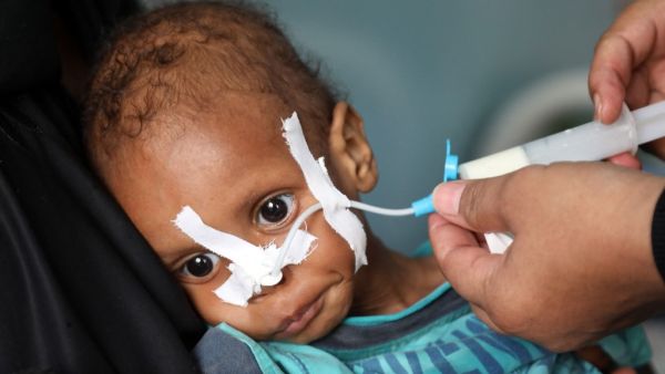 Hunger increased since the beginning of the coronavirus pandemic