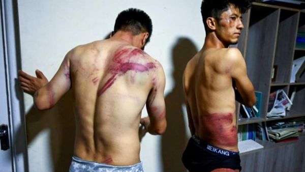 Two Afghan journalists were left with ugly welts and bruises after being beaten and detained for hours by Taliban enforcers for covering a protest in the Afghan capital Kabul