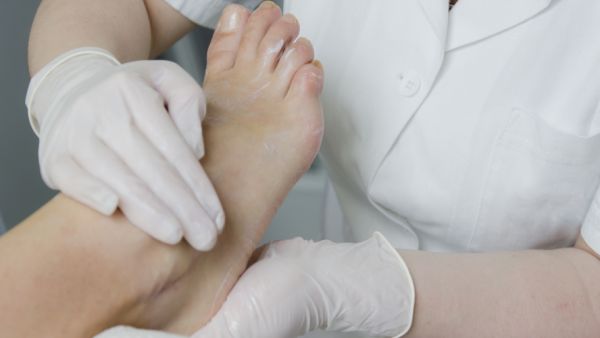 علاج القدم السكرية