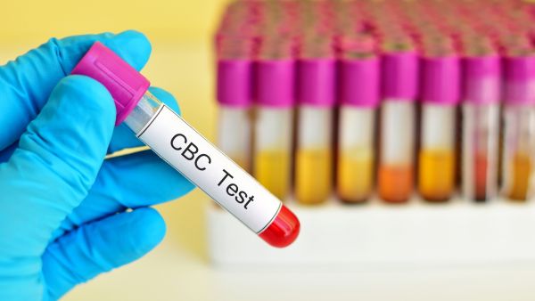 ما هو فحص تعداد الدم الكامل CBC؟