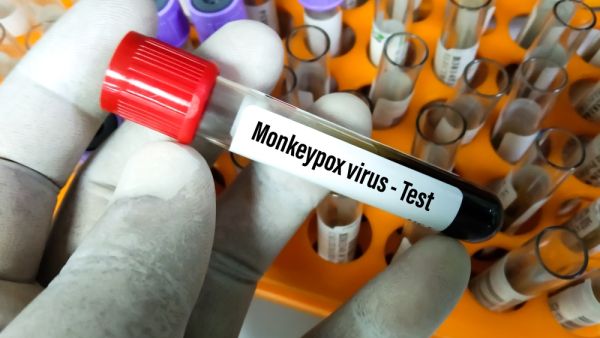 Mexico confirms 1st monkeypox case
