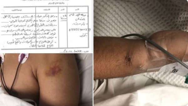 تعذيب المواطن عبد الله طامي