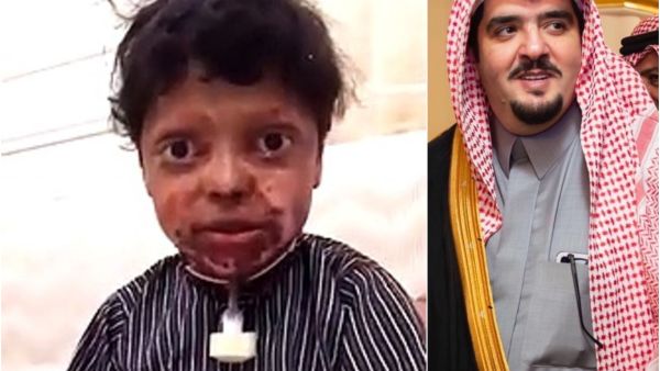 الأمير عبد العزيز بن فهد مع الطفل دحوم