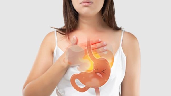 طبيب البوابة: 10 علاجات منزلية لتهدئة حرقة المعدة
