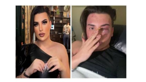 زعم الشاب المتحول جنسياً ستهر منذر  أن الذين اعتدوا عليه كانوا يحاولون التحرش به 