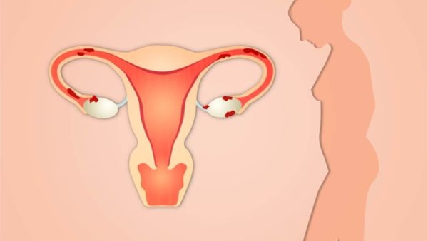 علامات رجوع الرحم لمكانه بعد التمريخ