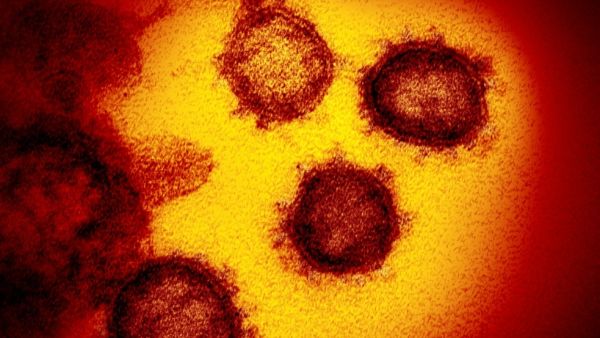 The electron virus 