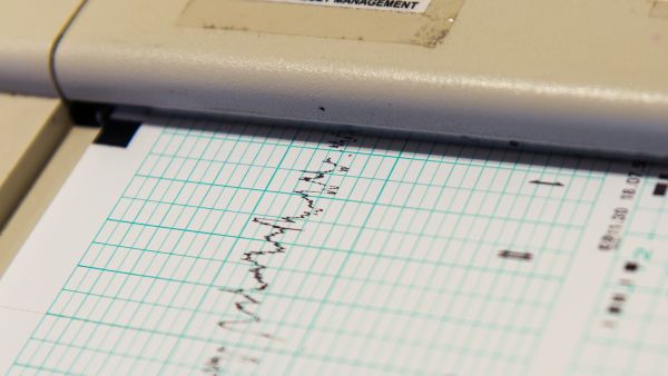  مقياس ريختر