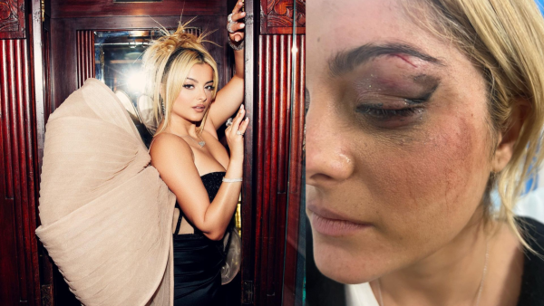 the man who hit Rexha with his phone purposely aimed for her face