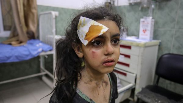 طفلة مصابة في عدوان اسرائيلي- صورة ارشيفية